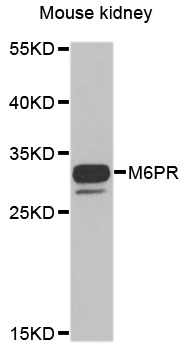 M6PR Antibody - Immunohistochemistry of paraffin-embedded human liver injury using M6PR antibody at dilution of 1:100 (x40 lens).