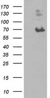 MAC-2-BP / LGALS3BP Antibody - HEK293T cells were transfected with the pCMV6-ENTRY control (Left lane) or pCMV6-ENTRY LGALS3BP (Right lane) cDNA for 48 hrs and lysed. Equivalent amounts of cell lysates (5 ug per lane) were separated by SDS-PAGE and immunoblotted with anti-LGALS3BP. At a dilution of 1:2000.
