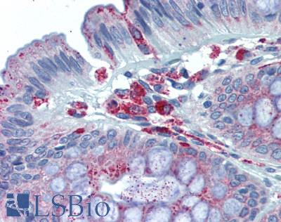 MAC-2-BP / LGALS3BP Antibody - Human Colon: Formalin-Fixed, Paraffin-Embedded (FFPE), at  a concentration of 10 ug/ml. 