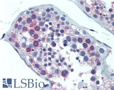 MAC-2-BP / LGALS3BP Antibody - Human Testis: Formalin-Fixed, Paraffin-Embedded (FFPE), at  a concentration of 10 ug/ml. 