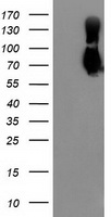 MAC-2-BP / LGALS3BP Antibody - HEK293T cells were transfected with the pCMV6-ENTRY control (Left lane) or pCMV6-ENTRY LGALS3BP (Right lane) cDNA for 48 hrs and lysed. Equivalent amounts of cell lysates (5 ug per lane) were separated by SDS-PAGE and immunoblotted with anti-LGALS3BP.