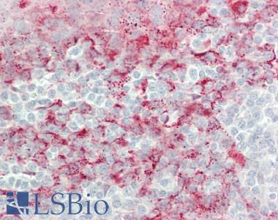 MAC-2-BP / LGALS3BP Antibody - Human Tonsil: Formalin-Fixed, Paraffin-Embedded (FFPE)
