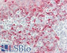 MAC-2-BP / LGALS3BP Antibody - Human Tonsil: Formalin-Fixed, Paraffin-Embedded (FFPE)