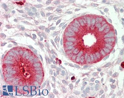 MAC-2-BP / LGALS3BP Antibody - Human Uterus: Formalin-Fixed, Paraffin-Embedded (FFPE)