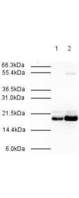 MAD2B / REV7 Antibody - Anti-MAD2L2 Antibody - Western Blot. Affinity Purified Rabbit anti-MAD2L2 was used at a 1:500 dilution to detect human MAD2L2 by western blot. Both HeLa whole cell lysate (lane 1) and nuclear lysate (lane 2) were probed using this antibody. This antibody clearly detects a ~20 kD band corresponding to human MAD2L2 (predicted molecular weight is 24 kD). Approximately 20 ug of each lysate was loaded on a 10% SDS-PAGE. Primary antibody was reacted with the membrane at room temperature for 1 h. After subsequent washing, a 1:2000 dilution of HRP conjugated Gt-a-Rabbit IgG was used for visualization. Exposure time was 30 sec.