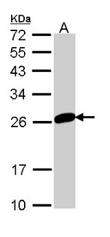 MAD2L1 / MAD2 Antibody - Sample (30 ug of whole cell lysate). A: 293T. 12% SDS PAGE. MAD2L1 antibody diluted at 1:1000. 