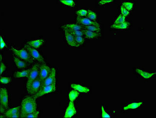 MAdCAM-1 Antibody - Immunofluorescent analysis of HepG2 cells using MADCAM1 Antibody at dilution of 1:100 and Alexa Fluor 488-congugated AffiniPure Goat Anti-Rabbit IgG(H+L)