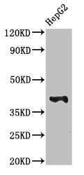MAdCAM-1 Antibody - Western Blot Positive WB detected in: HepG2 whole cell lysate All lanes: MADCAM1 antibody at 3µg/ml Secondary Goat polyclonal to rabbit IgG at 1/50000 dilution Predicted band size: 41, 29, 32, 22 kDa Observed band size: 41 kDa