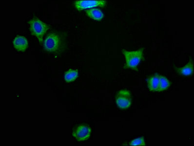 MAG Antibody - Immunofluorescence staining of MCF-7 cells with MAG Antibody at 1:416, counter-stained with DAPI. The cells were fixed in 4% formaldehyde, permeabilized using 0.2% Triton X-100 and blocked in 10% normal Goat Serum. The cells were then incubated with the antibody overnight at 4°C. The secondary antibody was Alexa Fluor 488-congugated AffiniPure Goat Anti-Rabbit IgG(H+L).