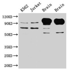 MAG Antibody - Western Blot Positive WB detected in: SH-SY5Y whole cell lysate, Rat brain tissue All lanes: MAG antibody at 5µg/ml Secondary Goat polyclonal to rabbit IgG at 1/50000 dilution Predicted band size: 70, 64, 67 kDa Observed band size: 70, 100 kDa