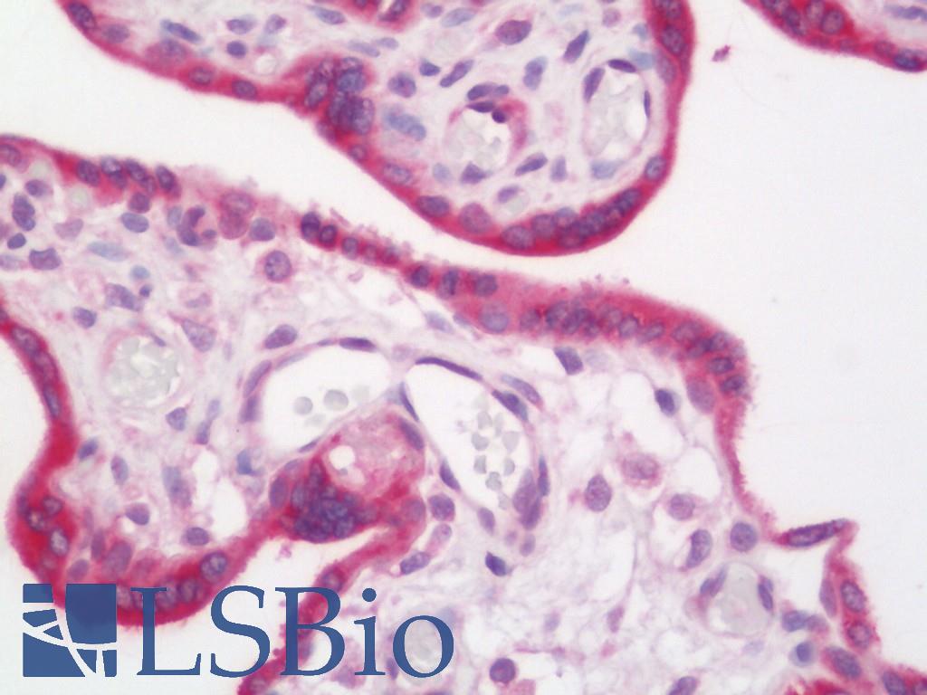 MAGEA3 Antibody - Human Placenta: Formalin-Fixed, Paraffin-Embedded (FFPE)