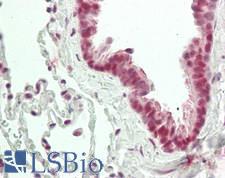 MAGEA9 Antibody - Human Lung: Formalin-Fixed, Paraffin-Embedded (FFPE)
