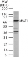 MALT1 Antibody - Western blot ofumALT1 in Jurkat cell lysate using antibody at 0.5 ug/ml.