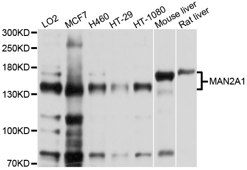 MAN2A1 / Mannosidase II Antibody - Western blot analysis of extracts of various cell lines, using MAN2A1 antibody at 1:1000 dilution. The secondary antibody used was an HRP Goat Anti-Rabbit IgG (H+L) at 1:10000 dilution. Lysates were loaded 25ug per lane and 3% nonfat dry milk in TBST was used for blocking. An ECL Kit was used for detection and the exposure time was 1s.