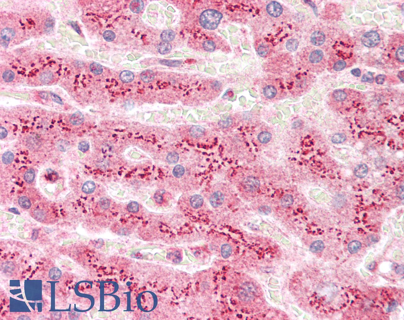 MAN2A1 / Mannosidase II Antibody - Human Liver: Formalin-Fixed, Paraffin-Embedded (FFPE)