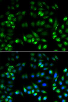 MANF / ARMET Antibody - Immunofluorescence analysis of U20S cell using MANF antibody. Blue: DAPI for nuclear staining.