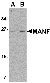 MANF / ARMET Antibody - Western blot of MANF in mouse brain tissue lysate with MANF antibody at (A) 1 and (B) 2 ug/ml. 