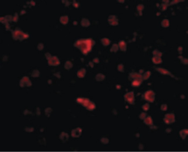 MANF / ARMET Antibody - Immunofluorescence of MANF in Human Brain cells with MANF antibody at 20 ug/ml.