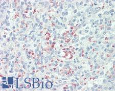 Mannose Receptor / CD206 Antibody - Anti-Mannose Receptor / CD206 antibody IHC staining of human spleen. Immunohistochemistry of formalin-fixed, paraffin-embedded tissue after heat-induced antigen retrieval. Antibody dilution 1:100.