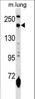 Mannose Receptor / CD206 Antibody - MRC1L1 Antibody western blot of mouse lung tissue lysates (35 ug/lane). The MRC1L1 antibody detected the MRC1L1 protein (arrow).