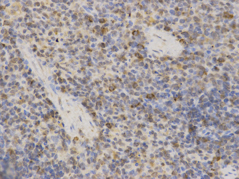 MAOA / Monoamine Oxidase Antibody - Immunohistochemistry of paraffin-embedded rat spleen using MAOA antibody at dilution of 1:100 (400x lens).