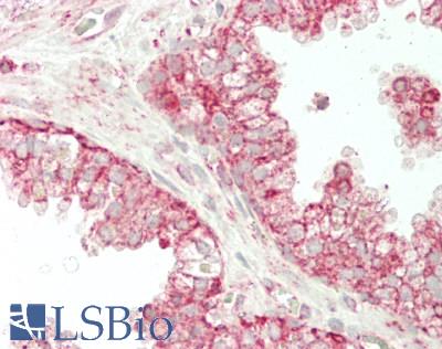 MAOA / Monoamine Oxidase Antibody - Human Prostate: Formalin-Fixed, Paraffin-Embedded (FFPE)