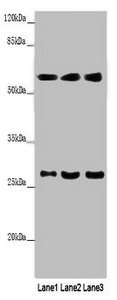 MAOB / Monoamine Oxidase B Antibody - Western blot All lanes: MAOB antibody at 9µg/ml Lane 1: Mouse liver tissue Lane 2: HepG2 whole cell lysate Lane 3: A549 whole cell lysate Secondary Goat polyclonal to rabbit IgG at 1/10000 dilution Predicted band size: 59, 47 kDa Observed band size: 59, 27 kDa