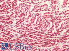 MAOB / Monoamine Oxidase B Antibody - Human Heart: Formalin-Fixed, Paraffin-Embedded (FFPE)