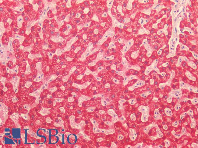 MAOB / Monoamine Oxidase B Antibody - Human Liver: Formalin-Fixed, Paraffin-Embedded (FFPE)