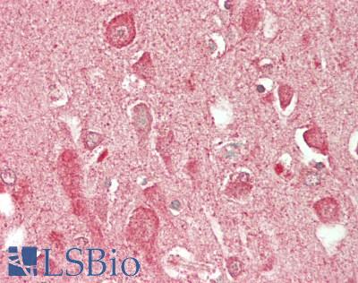 MAP1LC3 Antibody - Human Brain, Cortex: Formalin-Fixed, Paraffin-Embedded (FFPE)
