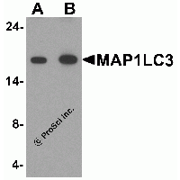 MAP1LC3 Antibody - Western blot analysis of MAP1LC3 in human brain tissue lysate with MAP1LC3 antibody at (A) 1 and (B) 2 µg/ml.