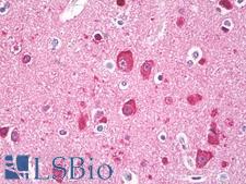MAP1LC3A / LC3A Antibody - Anti-LC3 antibody IHC of human brain, cortex neurons. Immunohistochemistry of formalin-fixed, paraffin-embedded tissue after heat-induced antigen retrieval. Antibody dilution 10 ug/ml.