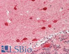 MAP1LC3A / LC3A Antibody - Human Brain, Cerebellum: Formalin-Fixed, Paraffin-Embedded (FFPE)