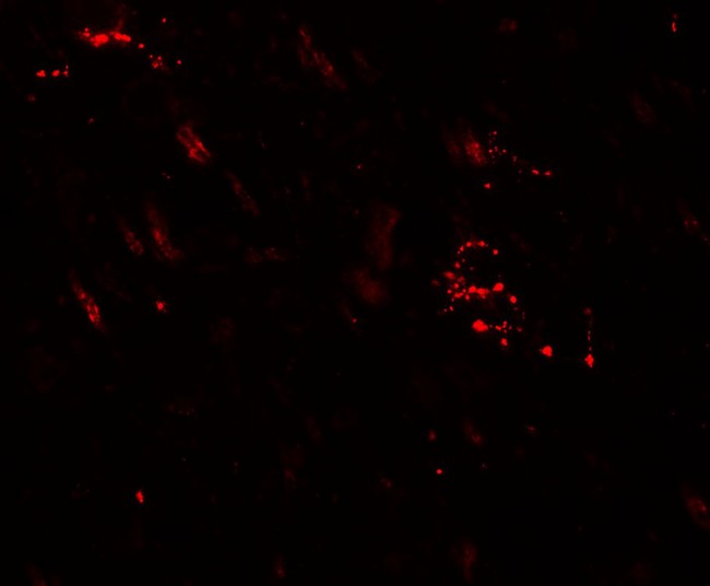 MAP1LC3A / LC3A Antibody - Immunofluorescence of MAP1LC3A in human brain tissue with MAP1LC3A antibody at 20 µg/mL.
