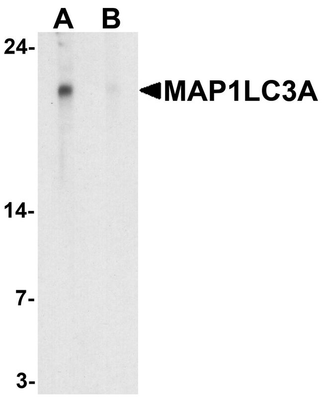 MAP1LC3A / LC3A Antibody - Western blot analysis of MAP1LC3A in HeLa cell lysate with MAP1LC3A antibody at 1 ug/ml in (A) the absence and (B) the presence of blocking peptide.