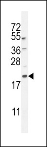 MAP1LC3B / LC3B Antibody - APG8a/b (MAP1LC3A/B) western blot of mouse lung tissue lysates (35 ug/lane). The MAP1LC3A antibody detected the MAP1LC3A protein (arrow).