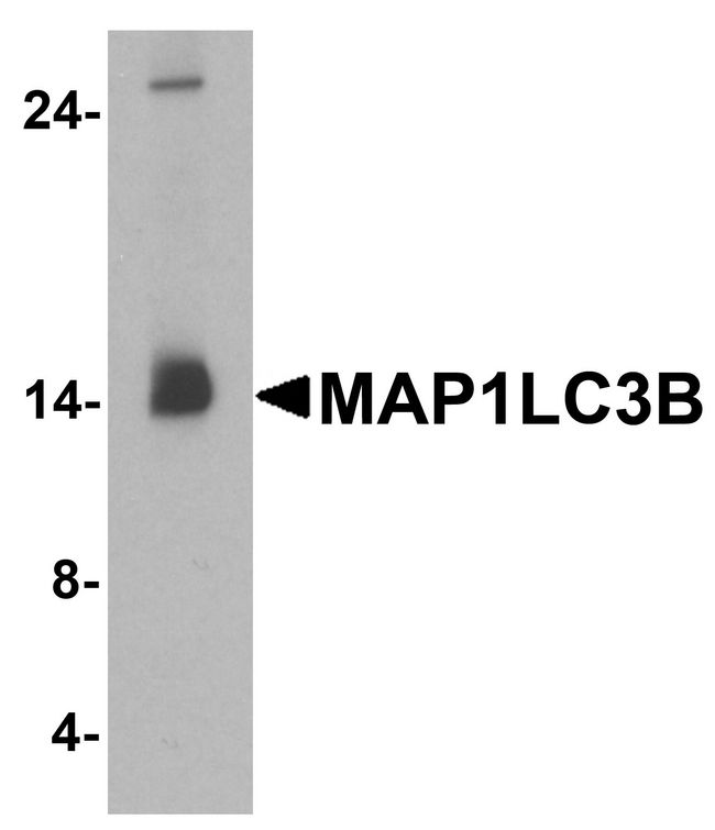 MAP1LC3B / LC3B Antibody - Western blot analysis of MAP1LC3B in human brain tissue lysate with MAP1LC3B antibody at 1 ug/ml.