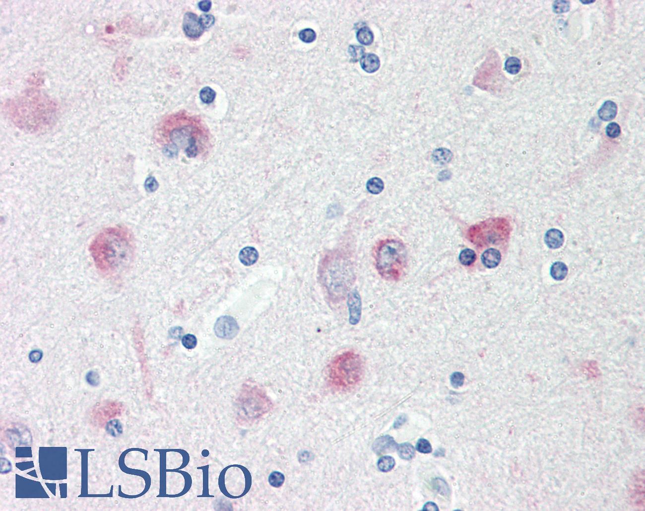 MAP1LC3B / LC3B Antibody - Anti-MAP1LC3B / LC3B antibody IHC staining of human brain, cortex. Immunohistochemistry of formalin-fixed, paraffin-embedded tissue after heat-induced antigen retrieval. Antibody dilution 1:50.