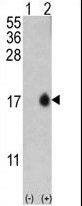 MAP1LC3B / LC3B Antibody - Western blot of MAP1LC3B (arrow) using rabbit polyclonal APG8b (MAP1LC3B) Antibody (T6). 293 cell lysates (2 ug/lane) either nontransfected (Lane 1) or transiently transfected with the MAP1LC3B gene (Lane 2) (Origene Technologies).