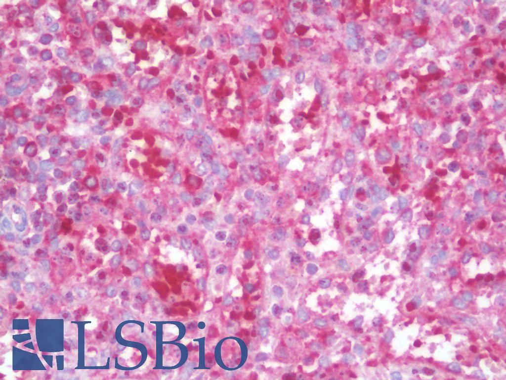 MAP1LC3C / LC3C Antibody - Anti-MAP1LC3C / LC3C antibody IHC staining of human spleen. Immunohistochemistry of formalin-fixed, paraffin-embedded tissue after heat-induced antigen retrieval. Antibody concentration 10 ug/ml.
