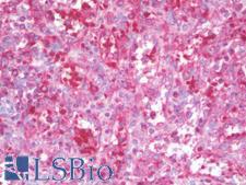 MAP1LC3C / LC3C Antibody - Anti-MAP1LC3C / LC3C antibody IHC staining of human spleen. Immunohistochemistry of formalin-fixed, paraffin-embedded tissue after heat-induced antigen retrieval. Antibody concentration 10 ug/ml.