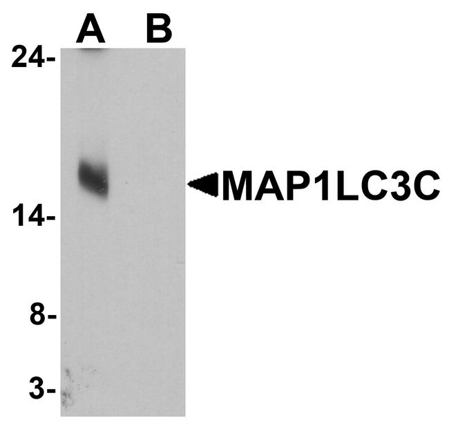 MAP1LC3C / LC3C Antibody - Western blot analysis of MAP1LC3C in human brain tissue lysate with MAP1LC3C antibody at 1 ug/ml in (A) the absence and (B) the presence of blocking peptide.