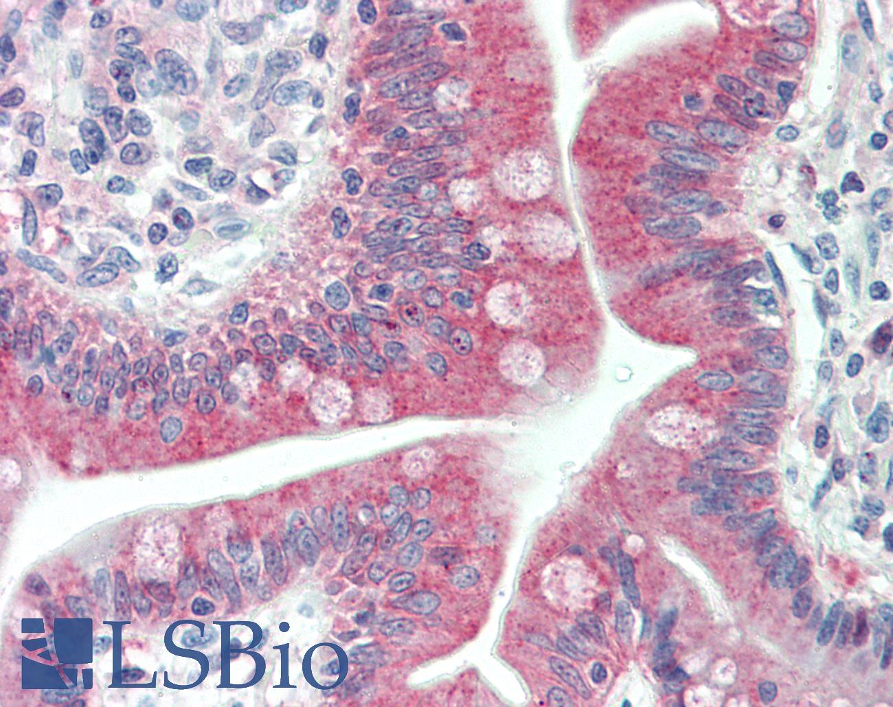 MAP1LC3C / LC3C Antibody - Anti-MAP1LC3C / LC3C antibody IHC staining of human small intestine. Immunohistochemistry of formalin-fixed, paraffin-embedded tissue after heat-induced antigen retrieval. Antibody dilution 1:100.