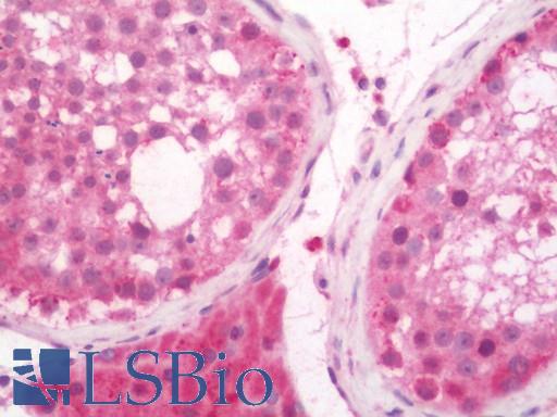 MAP1S Antibody - Human Testis: Formalin-Fixed, Paraffin-Embedded (FFPE).  This image was taken for the unconjugated form of this product. Other forms have not been tested.