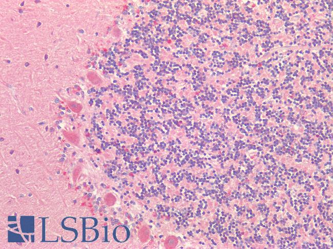 MAP2 Antibody - Human Brain, Cerebellum: Formalin-Fixed, Paraffin-Embedded (FFPE)