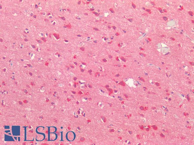 MAP2 Antibody - Human Brain, Cortex: Formalin-Fixed, Paraffin-Embedded (FFPE)