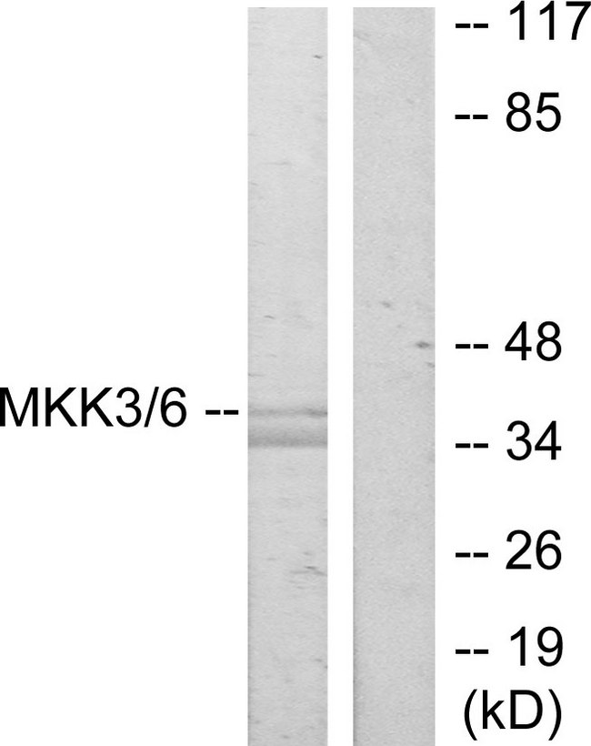 MAP2K3 / MEK3 / MKK3 Antibody - Western blot analysis of lysates from MDA-MB-435 cells, using MKK3 Antibody. The lane on the right is blocked with the synthesized peptide.