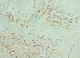 MAP2K5 / MEK5 Antibody - Immunohistochemistry of paraffin-embedded human gallbladder using antibody at 1:100 dilution.