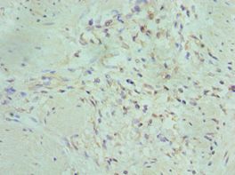 MAP2K5 / MEK5 Antibody - Immunohistochemistry of paraffin-embedded human gallbladder using antibody at 1:100 dilution.
