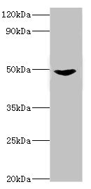 MAP2K5 / MEK5 Antibody - Western blot All lanes: Dual specificity mitogen-activated protein kinase kinase 5 antibody at 2µg/ml + Rat heart tissue Secondary Goat polyclonal to rabbit IgG at 1/10000 dilution Predicted band size: 51, 49, 50, 47 kDa Observed band size: 51 kDa